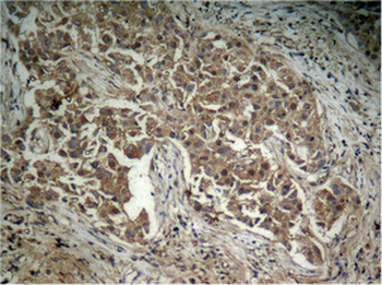 AKT1 Antibody