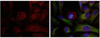 AKT1 Antibody