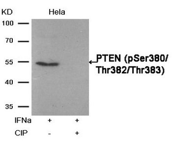 PTEN Antibody