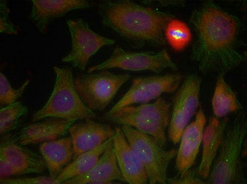 PTEN Antibody