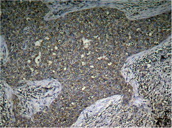 MTOR Antibody