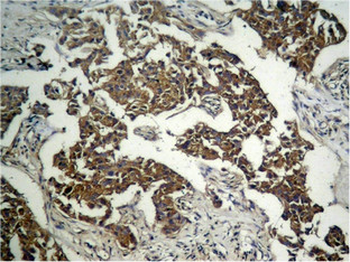 GSK3B Antibody