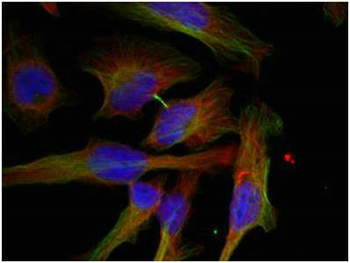 GSK3B Antibody