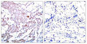 RELA Antibody