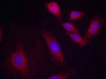 RELA Antibody
