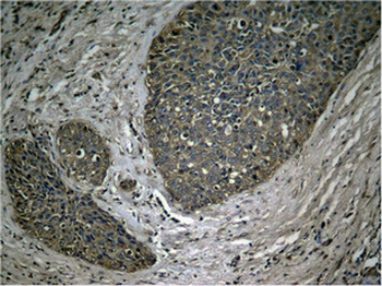 RELA Antibody