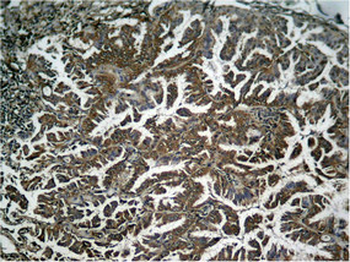 RELA Antibody