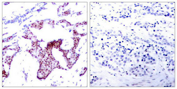 RELA Antibody