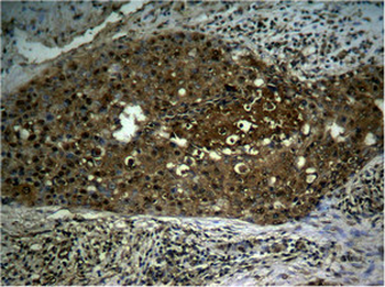 RELA Antibody