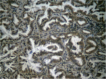 RELA Antibody