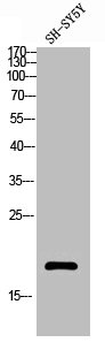 HIST1H3A/HIST2H3A/H3F3A Antibody