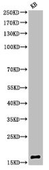 HIST1H3A/HIST2H3A/H3F3A Antibody