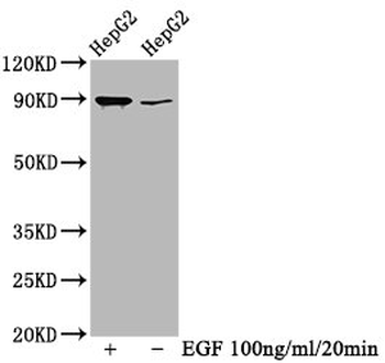 RPS6KA1 Antibody
