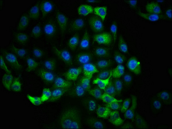 RPS6KA1 Antibody