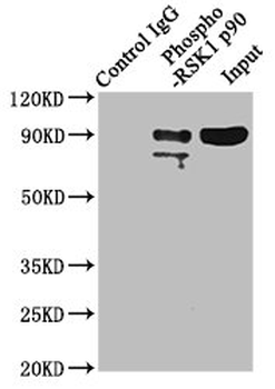 RPS6KA1 Antibody