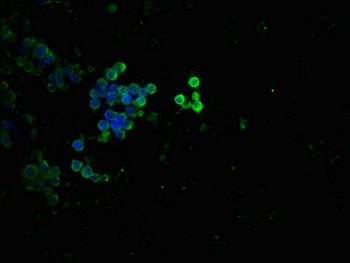 TP53 Antibody