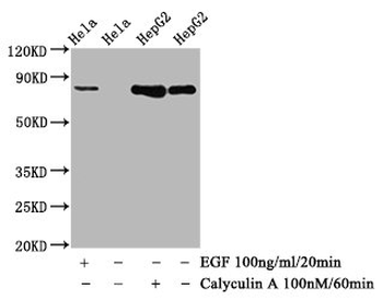 GYS1 Antibody