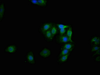 GYS1 Antibody