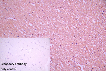 EIF2AK2 Antibody