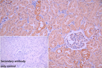 EIF2AK2 Antibody
