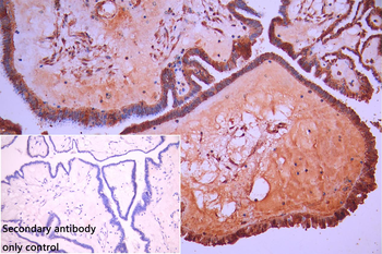 EIF2AK2 Antibody