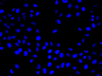 EIF2AK2 Antibody