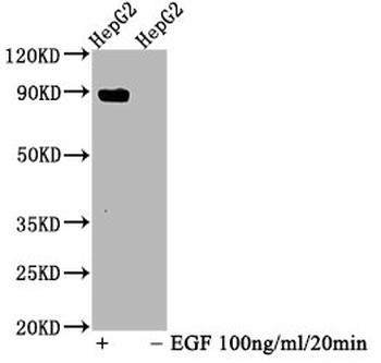 STAT5A Antibody