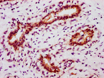 STAT5A Antibody