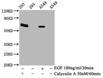 PRKAA2 Antibody