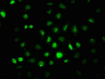 PRKAA2 Antibody