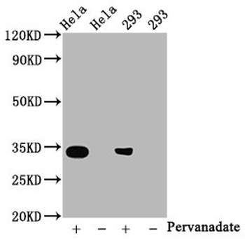 CDK2 Antibody