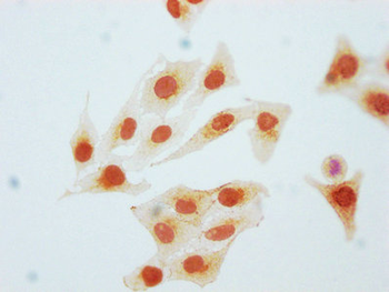 CDK2 Antibody