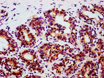 STAT3 Antibody