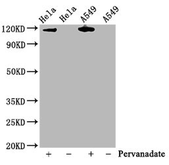 JAK2 Antibody