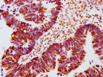 JAK2 Antibody