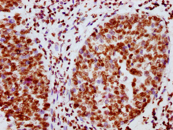 JAK2 Antibody