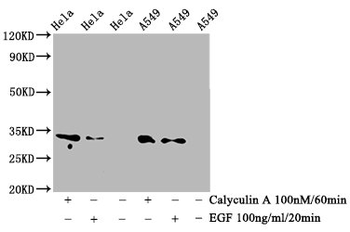 CDK1/CDK2/CDK3 Antibody