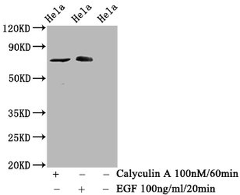 RAF1 Antibody