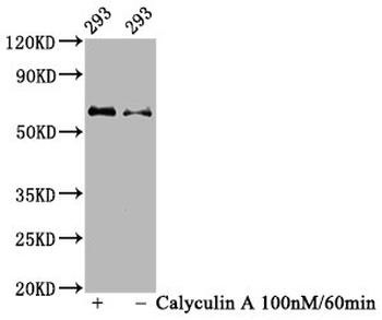 AKT1 Antibody