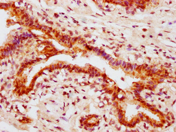 AKT1 Antibody