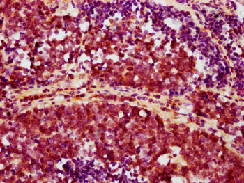 AKT1 Antibody