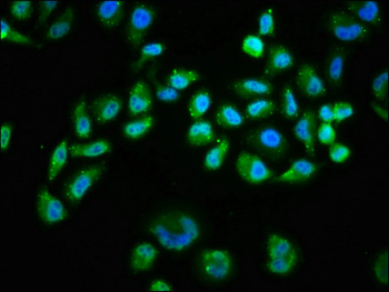 AKT1 Antibody