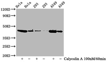 GSK3B Antibody