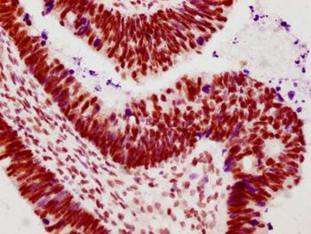 POLR2A Antibody