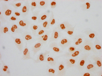 POLR2A Antibody