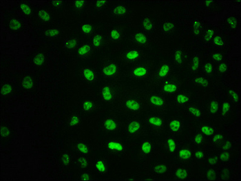 ATM Antibody