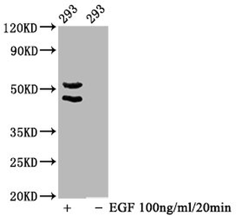 MAPK8/MAPK9/MAPK10 Antibody