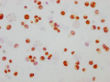 MAPK8/MAPK9/MAPK10 Antibody