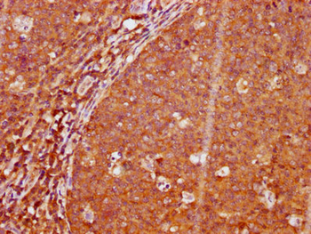 LAT Antibody