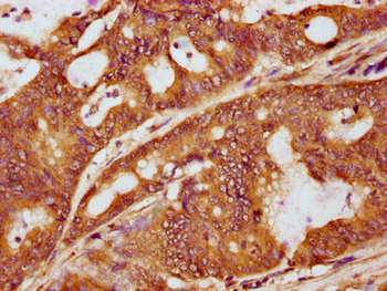 LAT Antibody